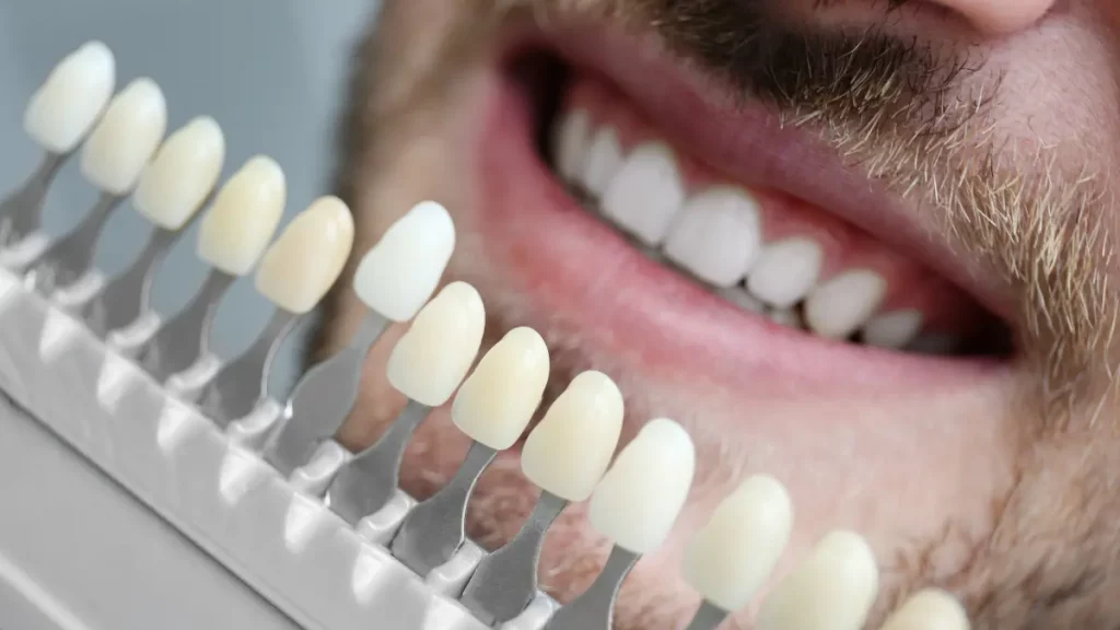 O que não pode comer com lente de contato dental