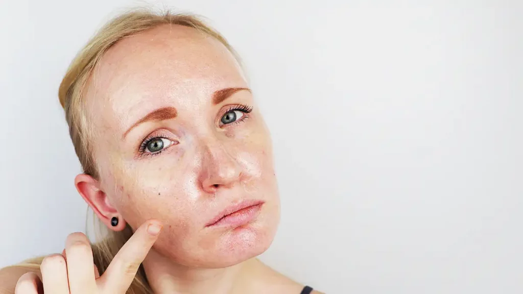 Produtos de skincare para pele oleosa Produtos de skincare para pele oleosa